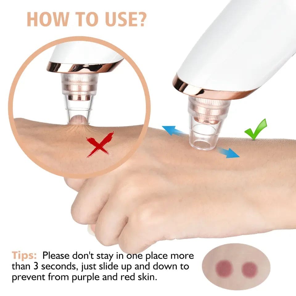 Beauty Electric Dermaclear