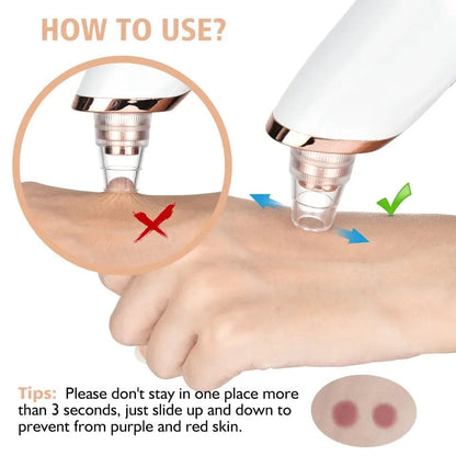 Beauty Electric Dermaclear